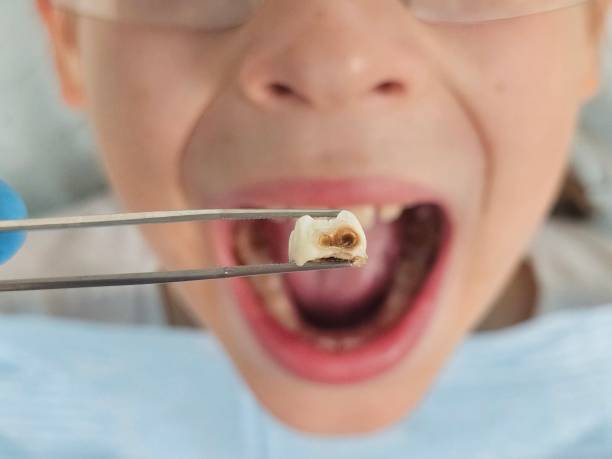 Best Weekend Emergency Dentist in De Motte, IN